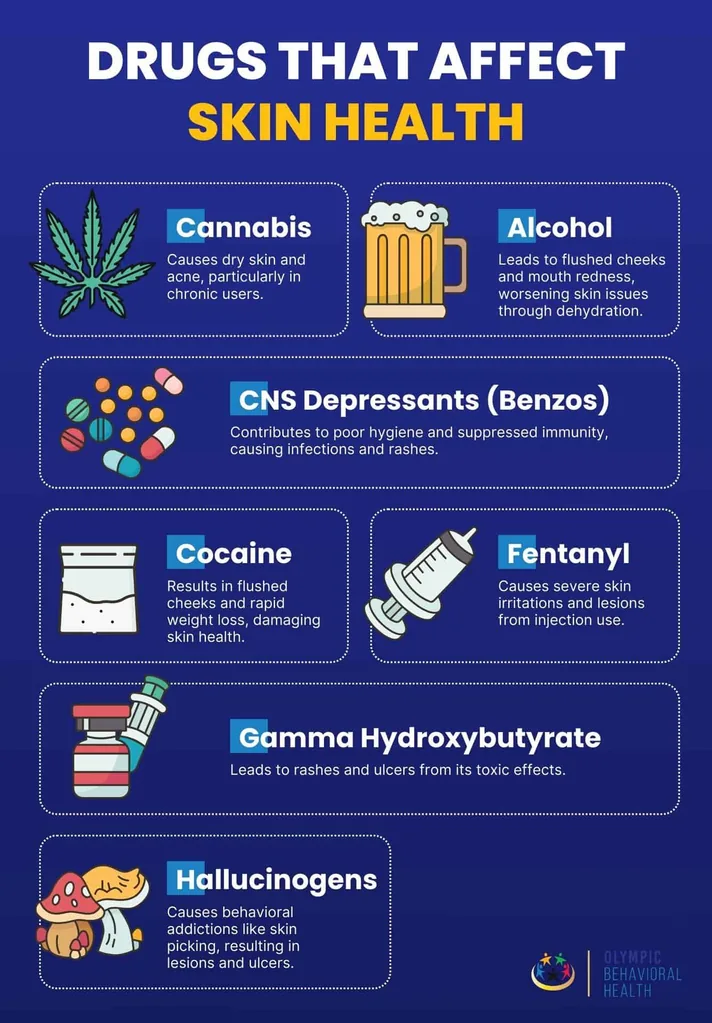Drugs that affect skin health: cannabis, alcohol, benzos, cocaine, fentanyl, GHB and hallucinogens and their skin effects