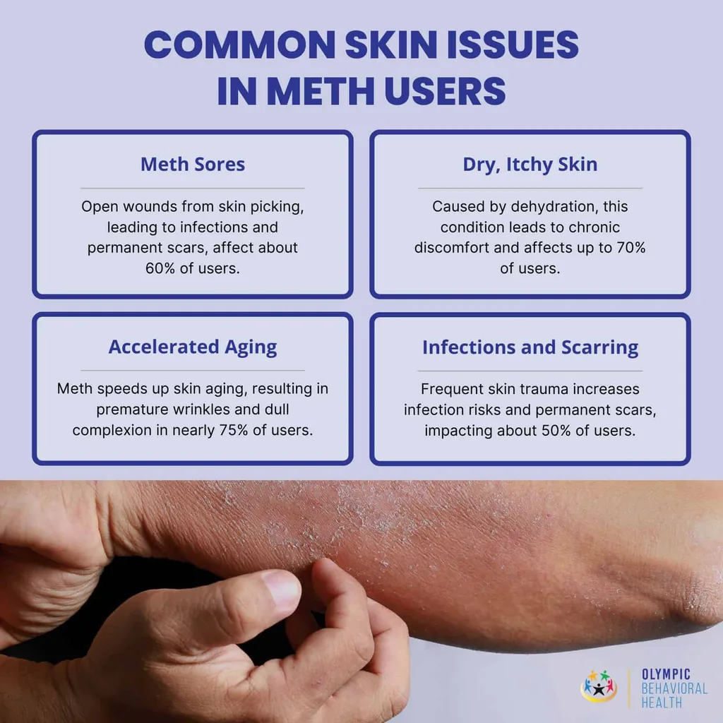 Common skin issues in meth users: meth sores, dry itchy skin, accelerated aging and infections and scarring