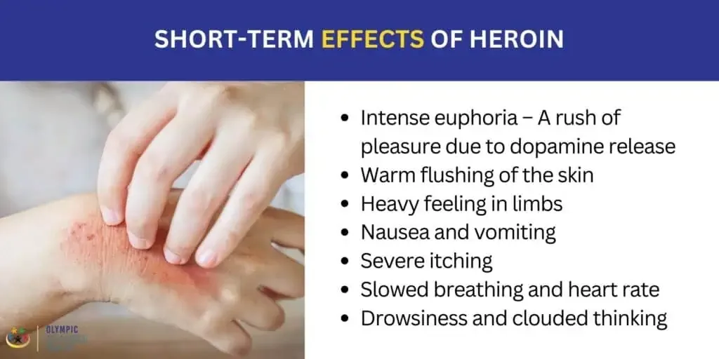 Short-term effects of heroin: euphoria, warm skin flushing, heavy limbs, nausea, itching, slowed breathing and drowsiness